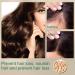 Hocossy Hair Growth Cream Hair Growth Serum Hair Loss and Thinning Hair Treatment Moisturizing Scalp Massage Rejuvenate Follicles - Buy Online on GoSupps.com