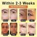  JIAOY VenomBoost Wake-Up Collagen Eye Cream Anti-Aging Eye Cream Instant Firming Against Dark Circles and Under-Eye Puffiness Reduces Fine Lines Puffiness and Wrinkles - Buy Online on GoSupps.com