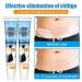 Vitiligo Therapy Cream: Soothing Ointment to Reduce White Spots & Improve Skin Pigmentation - Buy Online on GoSupps.com