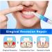 Furzero Oral Gum Treatment Gel Dentizen Gum Therapy Gel Furzero Gum Therapy Gel Gum Shield Therapy Gel Furzero Teeth Whitening Repair Regrowth Gel (4pcs) - Buy Online on GoSupps.com