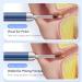 Ear Wax Removal Tool All-purpose Ear Picking Tweezers 8 Million Pixels Six-axis Gyroscope 3.2mm Lens Diameter 10-50mm Lens Depth 1.4-2cm Lens Focal Length Real-Time Remote Video Otoscope - Buy Online on GoSupps.com