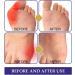 Strongjoints Anti Bunion Patch - Pain Relief & Protection (3 Boxes/15 Pcs) - Buy Online on GoSupps.com