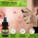 B Alive Pro Antimicrobial Hand & Face Spray - Non-Toxic Cleansing Formula - Safe for Mouth, Nose, Ears, Eyes - 30ml - Buy Online on GoSupps.com