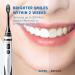 ORAL MASTER Sonic Electric Toothbrush - 5 Modes, 3 Intensity Levels, Dupont Bristles, 2-Min Timer, Rechargeable, IPX7 Waterproof - Adults Power Electric Toothbrush for Teeth Cleaning - Buy Online on GoSupps.com