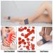 Copper Arch Support Sleeves - 2 Pairs for Plantar Fasciitis & Foot Pain Relief | Compression Bands for Flat Arches, Fallen Arches, Heel Spurs | Sizes M - L - Buy Online on GoSupps.com