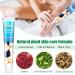 Vitiligo Therapy Cream: Soothing Ointment to Reduce White Spots & Improve Skin Pigmentation - Buy Online on GoSupps.com