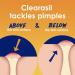 Clearasil Stubborn Acne Control 5in1 Exfoliating Wash Maximum Strenght with 2% Salicylic Acid Acne Treatment Medicine Daily Acne Facial Cleanser 6.78 fl oz (Pack of 2) - Buy Online on GoSupps.com