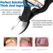 FERYES Precision Toe Nail Clippers - Professional Thick and Ingrown Nail Clipper with Stylish Design - Includes Leather Case - Buy Online on GoSupps.com