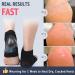 Cracked Heel Treatment Repair Socks - Premium Padded Compression Gel Sleeves for Dry Feet - 2 Pairs Spa Moisturizing Socks (One Size Fits Most - Buy Online on GoSupps.com