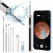 Ear Wax Removal Kit Otoscopes Visual Earwax Removal Camera 1080P FHD WiFi Wireless Ear Cleaner with 6 LED Light for Adults X8-white