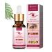 Stye Eye Treatment  Eye Stye Remover  Chalazion Remover  Stye Eye Relief Serum for Styes Chalazion and Blepharitis Treatment  Fast Relief  by RUIGEQIJI