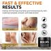 Urea Cream Urea 42% Foot Cream Ultra Moisturizing Heel Balm For Callus Removal and Soften Cracked Heel Repair Cream for Dry Skin Urea Lotion for Feet Hand & Body Maximum Strength - Buy Online on GoSupps.com