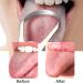 SHUBEIUMI Stainless Steel Tongue Scraper Set - 2Pcs | Metal Tongue Cleaner for Adults | U Shape, Reusable Cleaning Kit for Fresh Breath - Buy Online on GoSupps.com