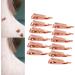 Skin Tag Remover Clips - Safe Copper Tool for Face Neck & Body | Effective Skin Tag Removal (12 Pack) - Buy Online on GoSupps.com