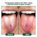 Silicone Tongue Brush Set - 4 Oral Hygiene Tools for Fresh Breath & Clean Tongue - Shenrongtong Dental Care - Buy Online on GoSupps.com