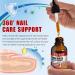 Traitement des Mycoses des Ongles 30ml - Soin Intensif l'Acide Und cyl nique 25% & Huiles Essentielles - R pare et Renforce les Ongles paissis Jaunis et Ab m s - Buy Online on GoSupps.com