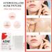 Zit Patches for Acne - 108Pcs Tea Tree Oil Clear Invisible Hydrocolloid Spot Dots - Day & Night Use - Buy Online on GoSupps.com