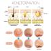 9PCS Blackhead Acne Removal Kit | Facial Skin Acne Removal Tool Set with Free Double-Headed Eyebrow Brush - Buy Online on GoSupps.com