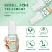 Back Acne Treatment Spray With Herbal Formula 2% Salicylic Acid & Tea Tree Oil - Body Acne Solution 120ml 1PCS - Buy Online on GoSupps.com