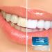 EverWhite Professional At Home Teeth Whitening Strips - 28 Pack - Buy Online on GoSupps.com