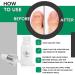 Yoffee Clear Nail Care - Anti Fungal Treatment for Finger and Toenails - 10 ml - Antibacterial - Made in Spain - Organic Argan Oil & Tea Tree Oil - Buy Online on GoSupps.com