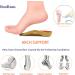 RooRuns Plantar Fasciitis Insoles - 3/4 Length Orthotic Inserts with Metatarsal Pads, Heel Cushion, High Arch Support for Flat Feet, Overpronation - Men (7-10.5) / Women (8-11.5) - Ideal for Walking, Running - Buy Online on GoSupps.com