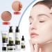 Skin Care Gifts for Women 5 in 1 Snail Collagen Skin Care Kit Includes Gentle Cleanser Toner Cream Serum Lotion Long Lasting Hydration  - Buy Online on GoSupps.com