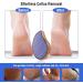 Nano Glass Heel Scraper (Blue Honeycomb) - Buy Online on GoSupps.com