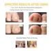 Ingrown Toenail Treatment Kit - Stainless Steel Corrector for Curved Toenails | Includes 12 Braces - Buy Online on GoSupps.com
