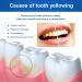Tooth Whitening Serum - 3 Pieces 30ml | Sensitive Teeth | Fresh Breath Stain Removal & Gum Protection - Buy Online on GoSupps.com