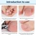 152-Piece Ingrown Toenail Tool Set & Correction Patch for Ingrown Toenails - International Shipping Available - Buy Online on GoSupps.com