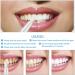 4 ml Tooth Pencil - Effective & Painless Whitening for Sensitive Teeth | 2 Natural Dental Treatments for Men & Women - Buy Online on GoSupps.com