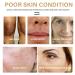 2PCS Turmeric Dark Spot Corrector Serum Oil - Natural Repair & Moisturizing Face & Body Treatment (30ml - Buy Online on GoSupps.com