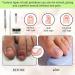 Ingrown Toenails Set Painless Nail Clip Toenails Ingrown Toenail Treatment Toenail Correction Including Nail Clippers and Other Accessories for Ingrown Toenails - Buy Online on GoSupps.com
