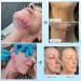 Minovd PDO Thread for Facelift | PDO Screw Thread 27G 60mm | V-Lift - 40pcs for Optimal Skin Tightening - Buy Online on GoSupps.com