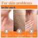 Turmeric Neck Firming Cream Neck Firming Cream Retinol Neck Cream for Sagging and Tightening Turmeric Neck Tightening Cream for Anti Aging Fade Fine Lines & Wrinkle Neck Double Chin Reducer-Face&Neck - Buy Online on GoSupps.com
