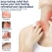 Buy Drawing Salve Cream for Boils & Cyst Removal | 2 Fl Oz (Pack of 8) - Itch Relief for Ingrown Hairs Splinters Bug Bites & More - Buy Online on GoSupps.com