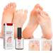 RZAJJN GFOUK Foot Corn Removal Extra Strength Gel 10ml - 2pcs - Buy Online on GoSupps.com