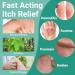 Extra Strength Anti Itch Cream - Long Lasting Relief for Rash Eczema Psoriasis & More - 3.53 OZ - Buy Online on GoSupps.com