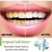  EXQST Ampoule Toothpaste Ampoule Serum Teeth Acid Fruit Whitening Essence Enamel Repair Toothpaste Deep Cleaning Toothpaste Removal - Buy Online on GoSupps.com