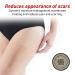 Neo G Opti-Heal Silicone Scar Strips for Surgical, C-Section, Burn, Acne, Keloid Treatment - 6 Strips - 1.6 x 5.9 inch - Medical Grade Scar Sheets - Buy Online on GoSupps.com