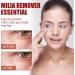 KOAHDE Milia Removal Face Serums Milia Spot Treatment Milia Treatment Spot Remover for Face Speedy Milia Remover Milia Spot Ruduce Face Serums Dark Spot Remover Face Serum Milia Removal Spot Care - Buy Online on GoSupps.com