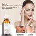 Retinol 1% In Squalane 30ml Retinol Serum for Face Face Serum for Women High -Strength for Face Reduce Fine Lines & Wrinkle Anti Aging Facial Serum Hyaluronic Acid Serum for Face Plump & Smooth Skin - Buy Online on GoSupps.com