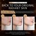 Snail Mucin Essence & Snail Eye Cream with Red Ginseng Face Moisturiser with Hyaluronic Acid Serum Niacinamide Serum Facial Serum for Hydrating Anti-Wrinkle Reduce Dark Circles Under Eyes - Buy Online on GoSupps.com