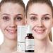 Retinoid 2% Emulsion Retinol Serum Retinol Serum High Strength for Face Hydrating Serum Retinoid Facial Serum Antiaging Face Serum Face Moisturiser Anti Wrinkle Serum Fade Fine Lines Skincare Serum - Buy Online on GoSupps.com
