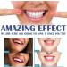 7 Day Active Gum Treatment Antibacterial Gum Treatment Gel Anti-Yellowness Serum for Stain Treatment Gum Treatment Gel Oral Cleaning - Buy Online on GoSupps.com
