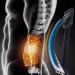Buy Verdant Touch Spine Deck Back Massage Device - Adjustable 3-Step Lumbar Cracker Stretcher in Blue & Black - International Shipping Available - Buy Online on GoSupps.com