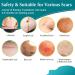 Silicone Scar Sheets Reusable Medical Grade Thinken Scar Sheet for C-Section Tummy Tuck Keloid Surgical Scars Post Surgery Supplies (16pcs-5.9"x1.6"Each Silicone Scar Sheet) - Buy Online on GoSupps.com