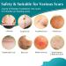 Silicone Scar Sheets - Professional Tape for Surgical Scars | C-Section, Burn, Keloid, Acne | 16 Pads (5.9 x 1.6) - Scar Removal Strips - Buy Online on GoSupps.com