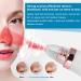Qukaim Blackhead Suction Instrument Electric Blackhead Removal Suction Face Pore Cleaner Acne Blackhead Remover Household Pore Cleaner - Buy Online on GoSupps.com